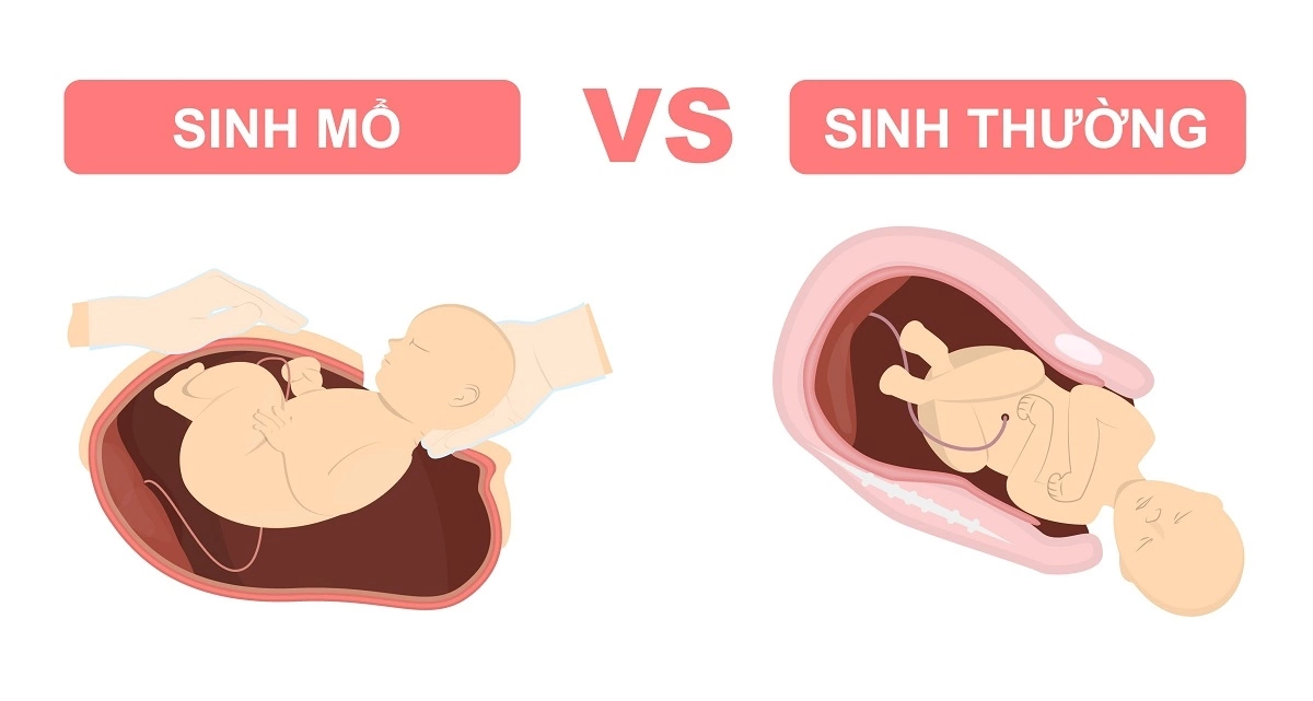 sinh-mo.png