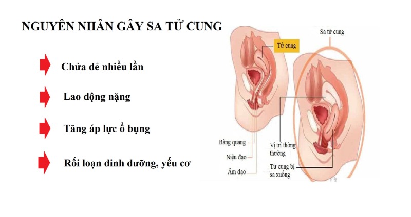sa-tu-cung-3.jpg
