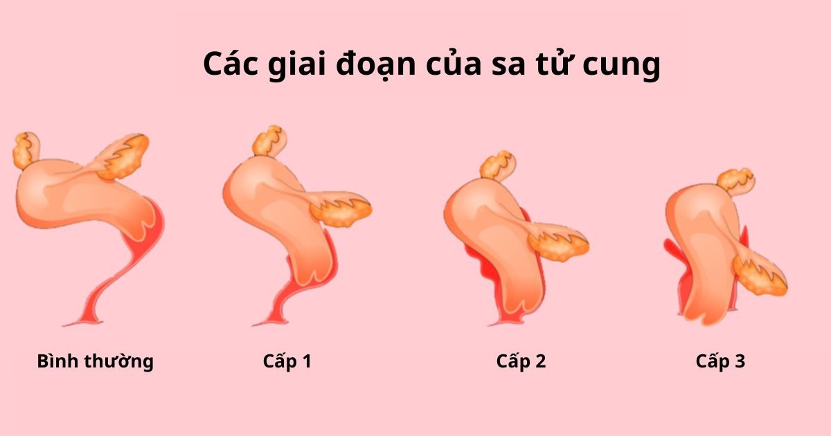 sa-tu-cung-do-1-0.jpg